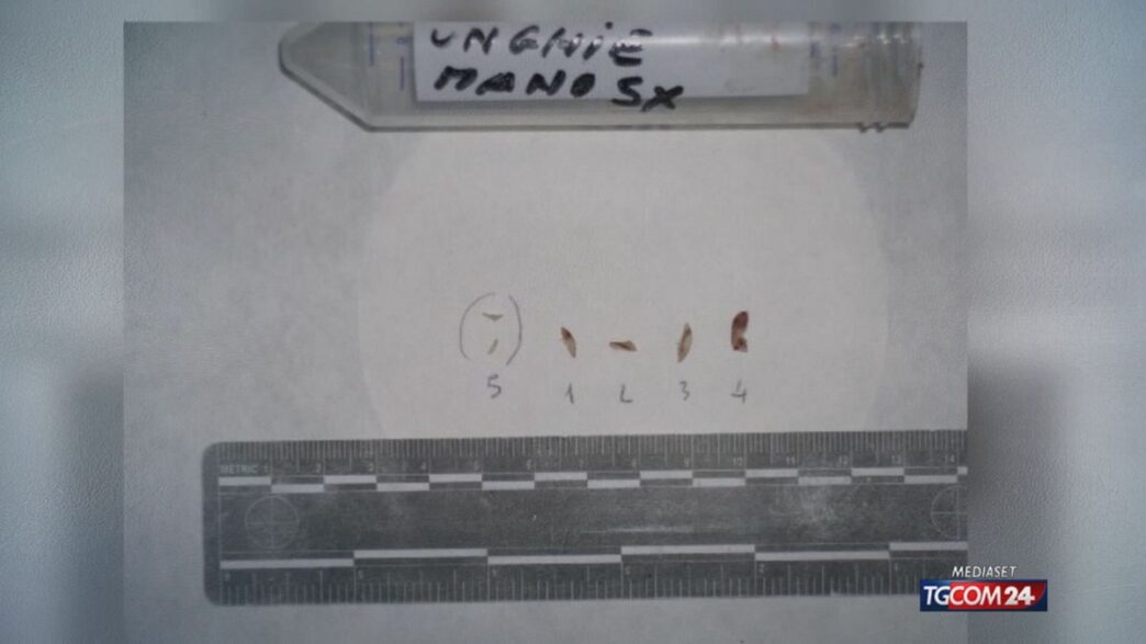 Dna Sotto Le Unghie Di Chiara