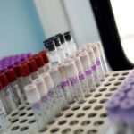 Il 66,5% Dei Pazienti Con Mielofibrosi Indipendenti Dalle Trasfusioni Dopo Trattamento Con Momelotinib In Italia