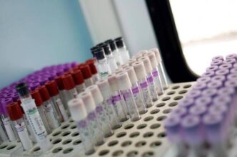 Il 662C525 Dei Pazienti Con Miel