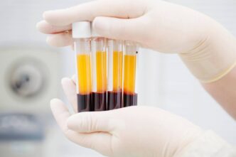 Il Dibattito Sulle28099Innovazione