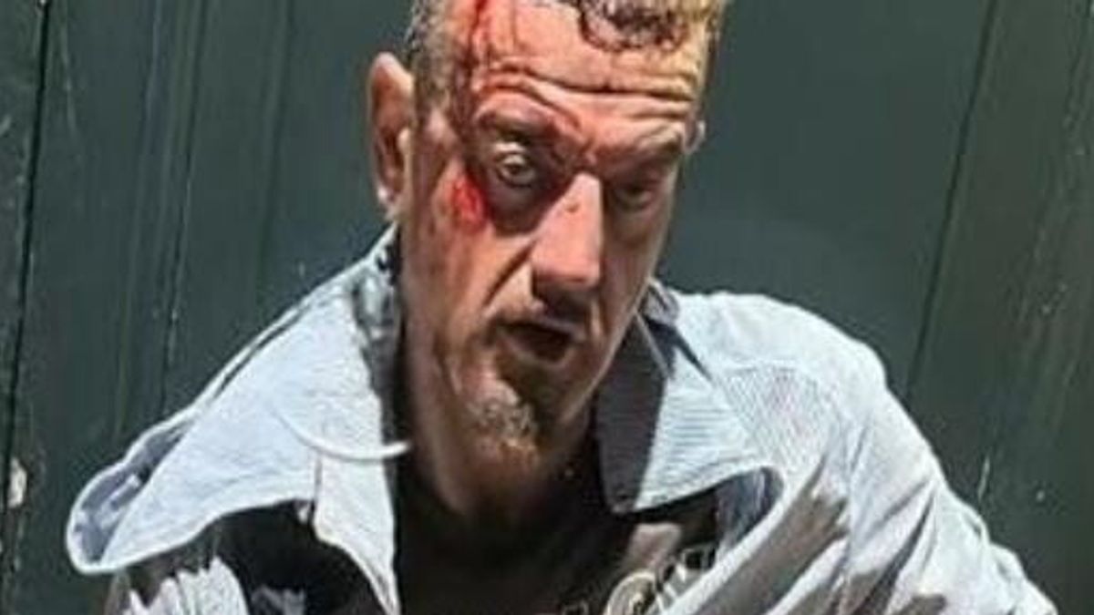 Indagato Accusato Di Omicidio
