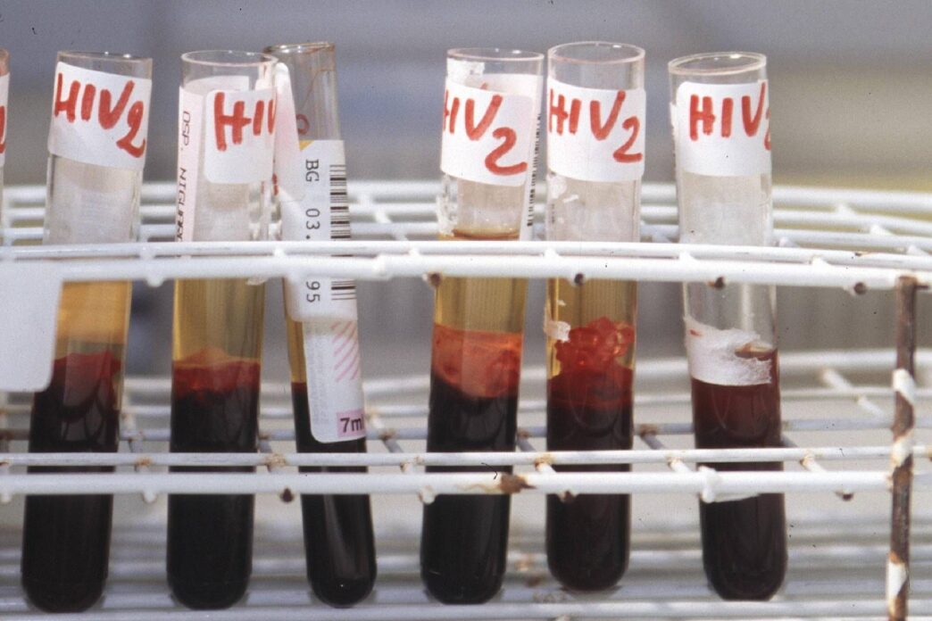 L27Aids Torna A Colpire3A Tagli