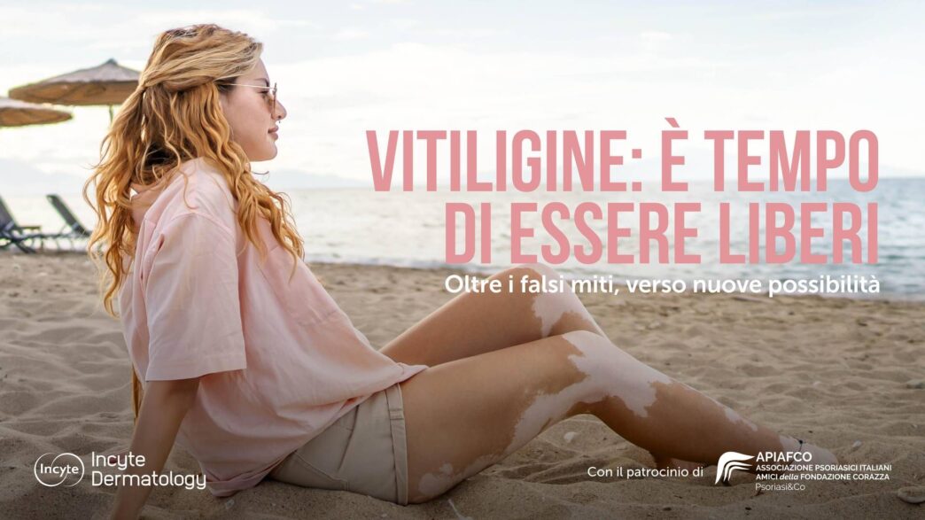 La Vitiligine Non C3A8 Solo Un Pr
