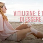 La Vitiligine Non È Solo Un Problema Estetico: Una Patologia Autoimmune Con Nuove Possibilità Di Cura