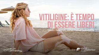 La Vitiligine Non C3A8 Solo Un Pr