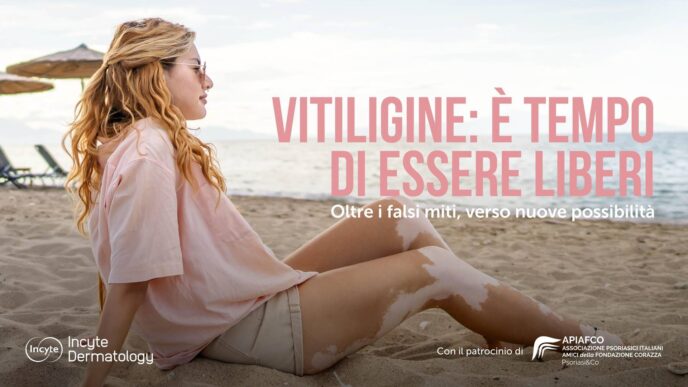 La Vitiligine Non C3A8 Solo Un Pr