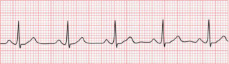 Nuove Prestazioni Di Telemedic