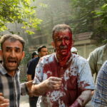 Oltre 1800 Feriti Civili Negli Attacchi Di Israel In Iran Dal 13 Giugno Secondo Il Ministro Della Salute