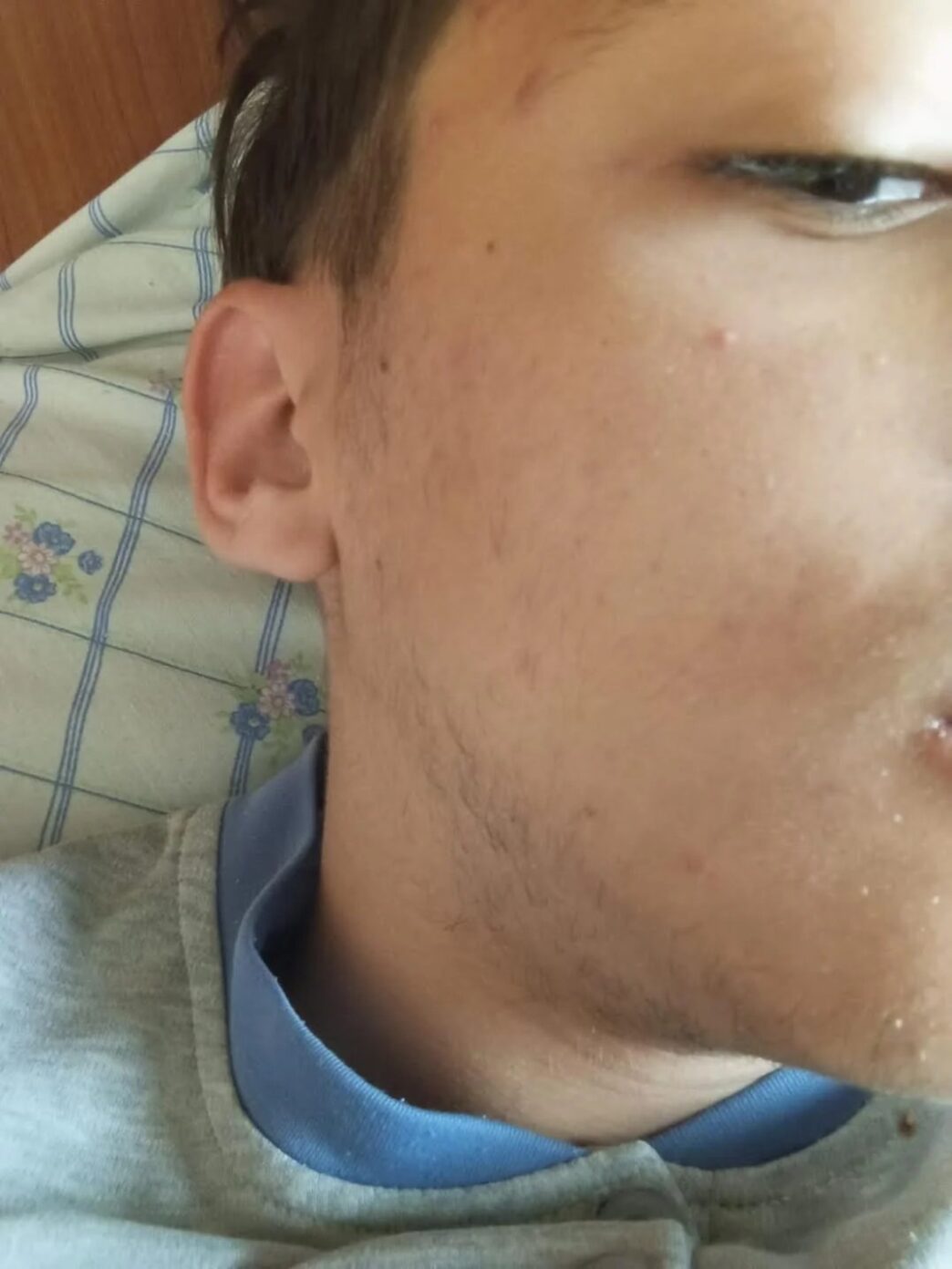 Rapina E Aggressione A Piazza