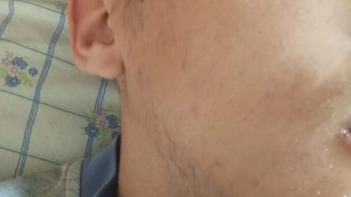 Rapina E Aggressione A Piazza