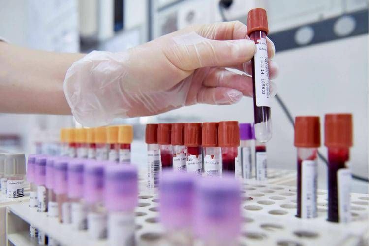 Test Genomici Nel Carcinoma Ma