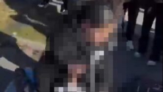 Una Ragazza Di 15 Anni Ammonit