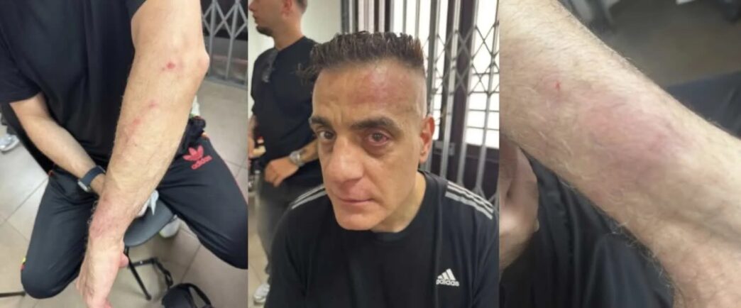 Aggressione A Cicalone Alla St