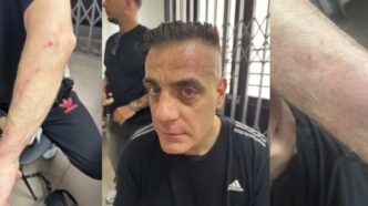 Aggressione A Cicalone Alla St