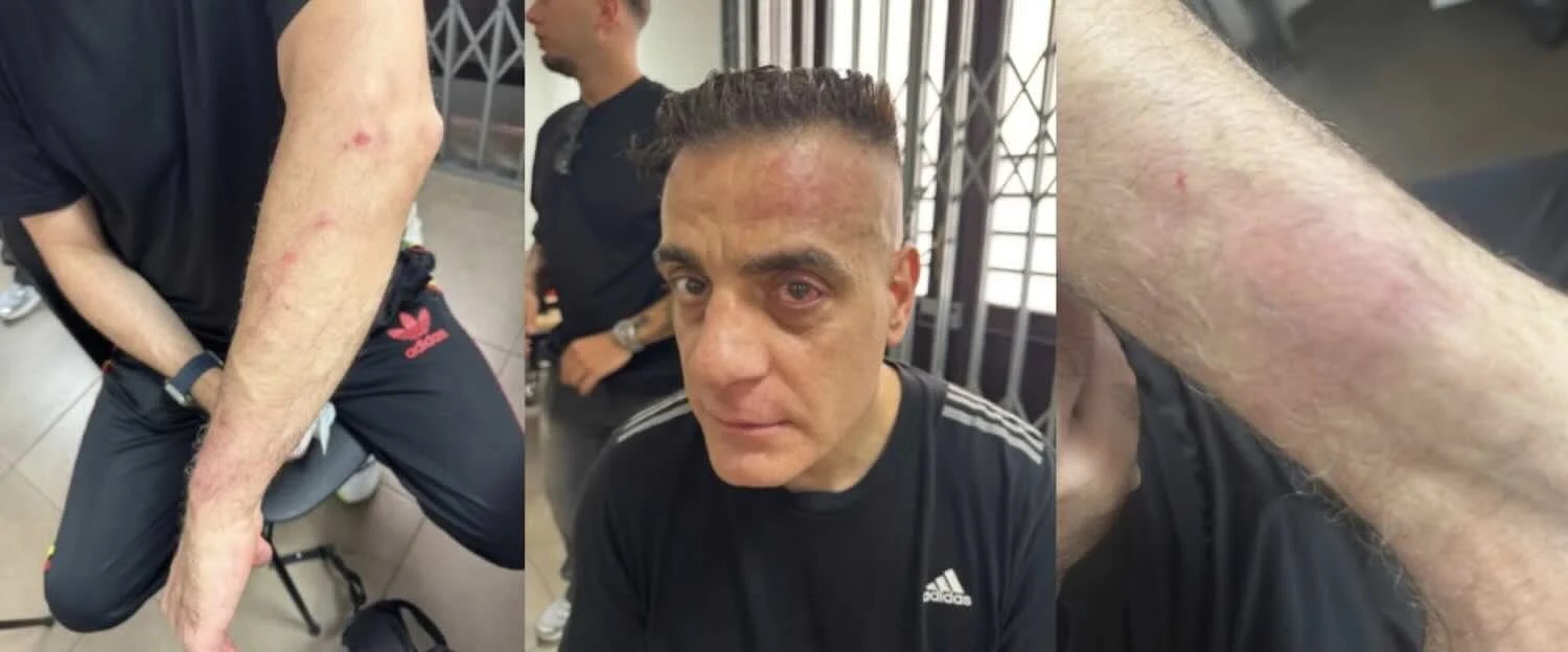 Aggressione A Cicalone Alla St