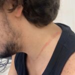 Baby Gang Agisce Durante Il Pizza Village Di Napoli: Aggressioni E Furti In Piena Area Concerto