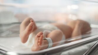 Bambina Prematura Operata Per