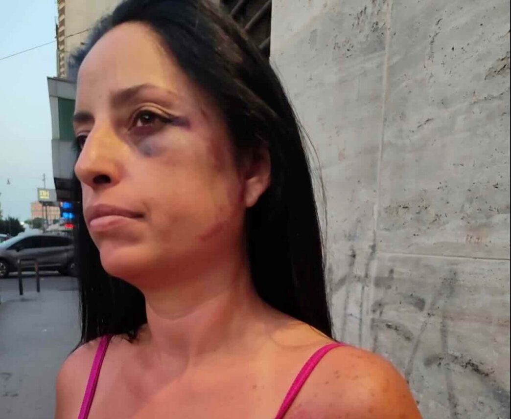 Donna Aggredita A Napoli Dal C