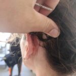 Donna Ferita In Via Montagna Spaccata A Napoli Da Colpo Sparato Con Pistola Ad Aria Compressa