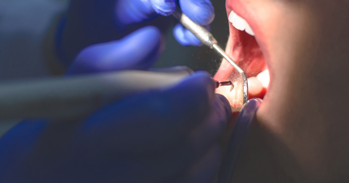 Falso Dentista A Ciric3A8 Scopert