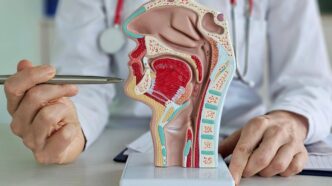 La Ue Approva Tislelizumab Con