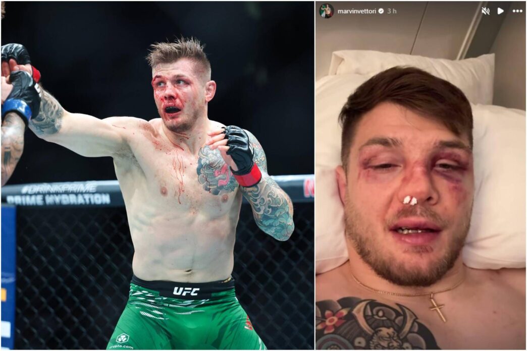 Marvin Vettori Perde Contro Br