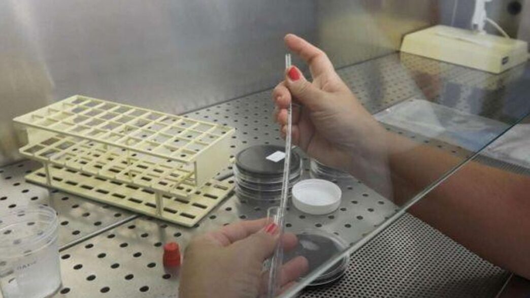 Problemi Con La Legionella Nel