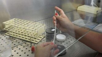 Problemi Con La Legionella Nel