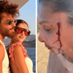 Sara Bluma Denuncia Violenze Domestiche E La Vicinanza Di Can Yaman Alla Sua Storia