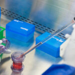 Scoperto Hunk, Nuovo Biomarcatore Che Accelera La Crescita Del Cancro Gastrico