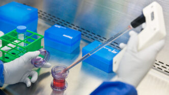 Scoperto Hunk2C Nuovo Biomarcat
