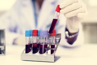 Una Nuova Forma Di Diabete Gio