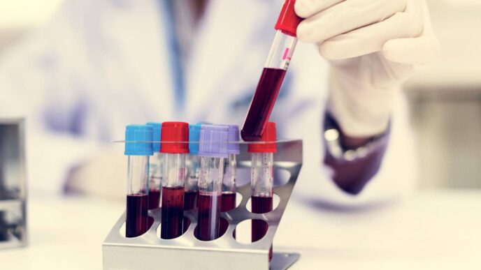Una Nuova Forma Di Diabete Gio