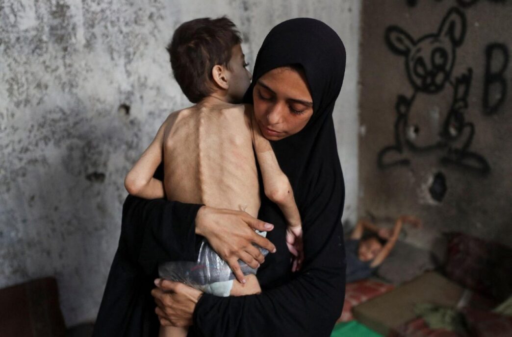La Morte Per Fame A Gaza Ripre