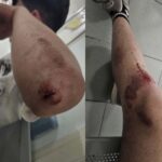14Enne Aggredito A Poggiomarino Dopo Una Caduta In Bicicletta, Cresce L’allarme Per La Violenza Giovanile