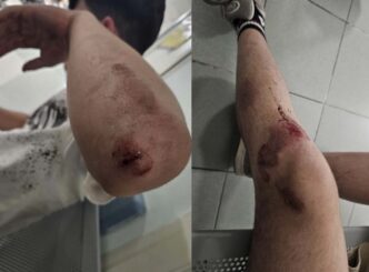 14Enne Aggredito A Poggiomarin