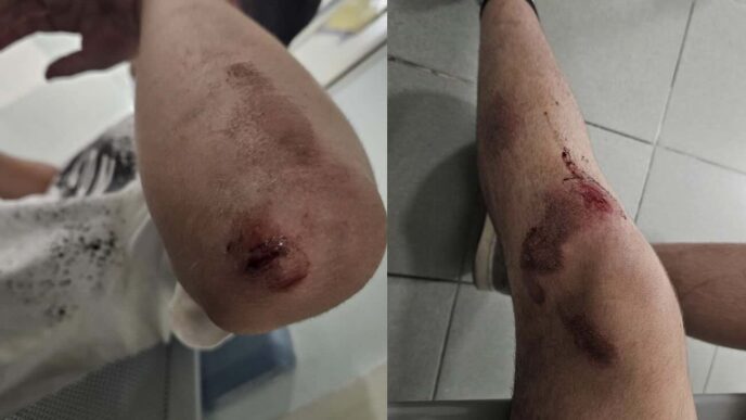 14Enne Aggredito A Poggiomarin