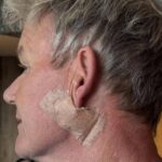Gordon Ramsay operato per carcinoma basocellulare: il suo appello per proteggersi dal sole