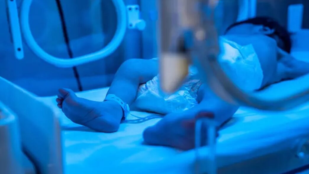 Neonato Con Teratoma Sacro Coc