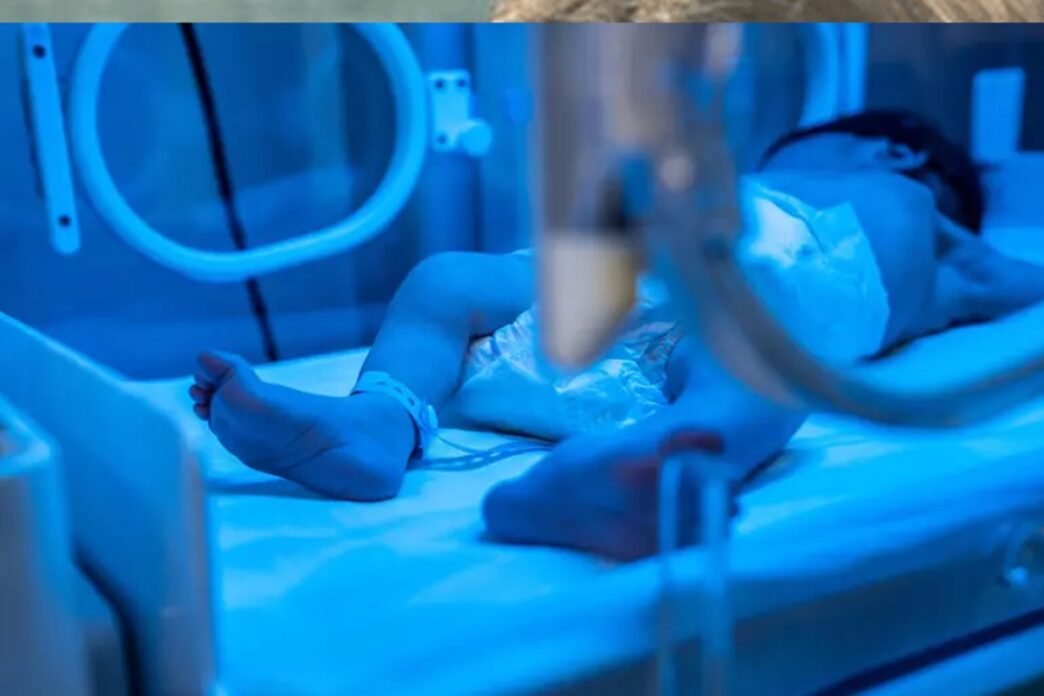 Neonato Con Teratoma Sacro Coc