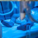 Neonato Con Teratoma Sacro-Coccigeo Nasce Prematuro A Roma E Viene Salvato Da Doppio Intervento Chirurgico